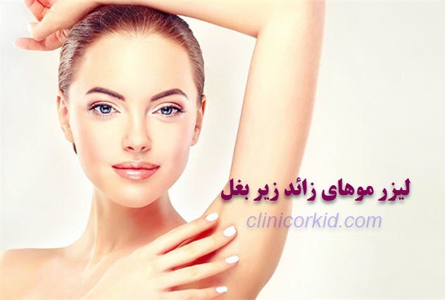 لیزر موهای زائد زیر بغل کلینیک ارکید