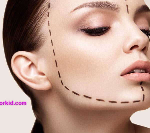 تزریق ژل فک و چانه در تهران کلینیک ارکید