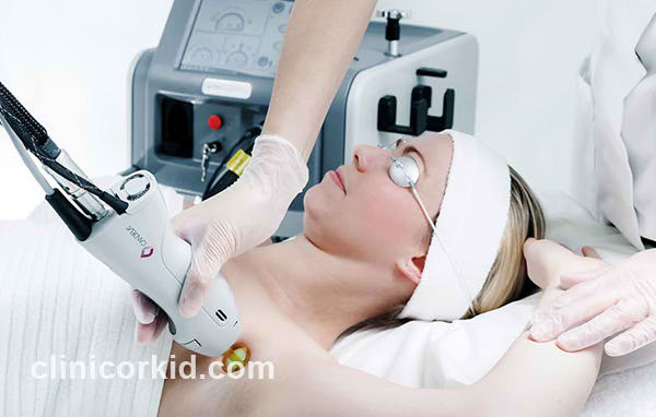 لیزر الکساندرایت | کلینیک ارکید