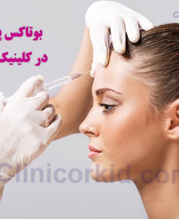 بوتاکس پیشانی کلینیک ارکید