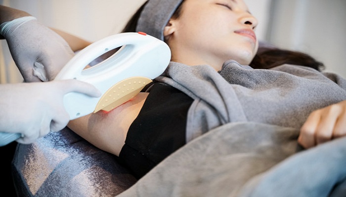 عوامل مؤثر در هزینه برای از بین بردن موهای زائد بدن