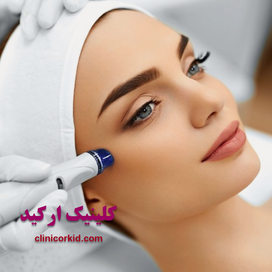 عوارض لیزر صورت کلینیک ارکید