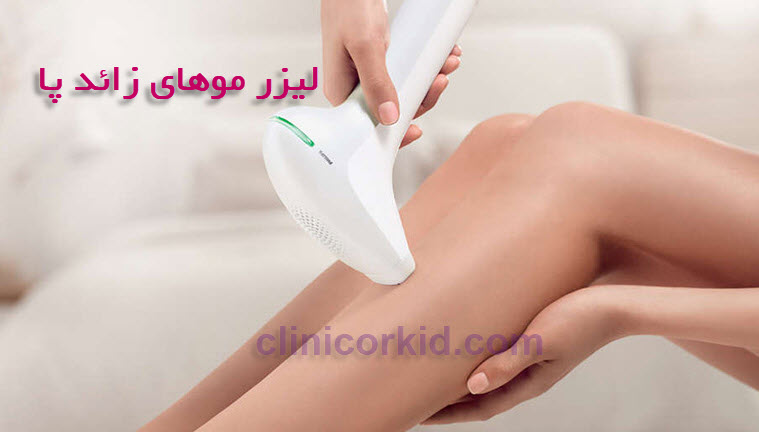 دستگاه لیزر موهای زائد پا کلینیک ارکید