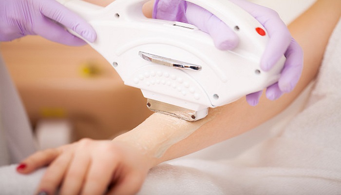 روش های از بین برنده موهای زائد