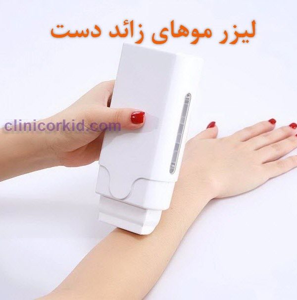 فوائد لیزر موهای زائد دست ها کلینیک ارکید
