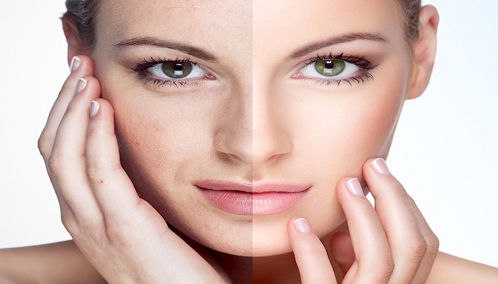 مرکز هایفوتراپی