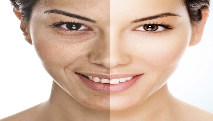 بهترین مرکز هایفوتراپی در تهران چه ویژ گی هایی دارد