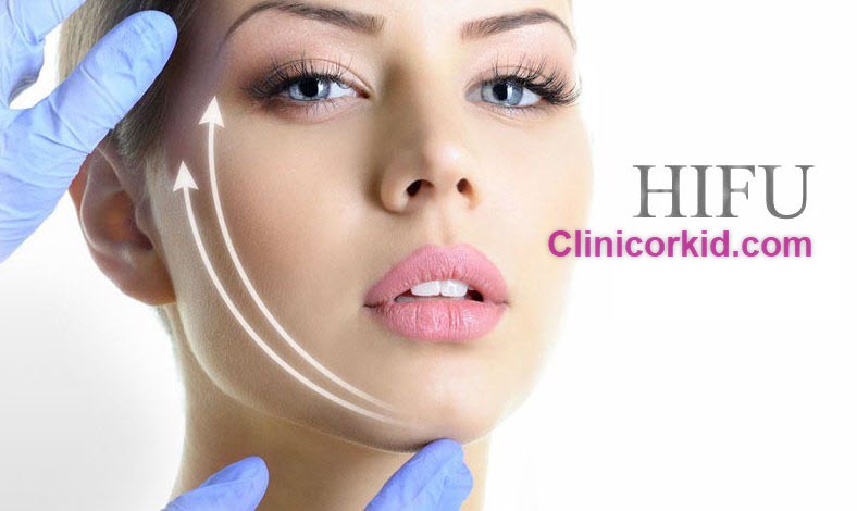 بهترین مرکز هایفوتراپی در تهران کلینیک ارکید