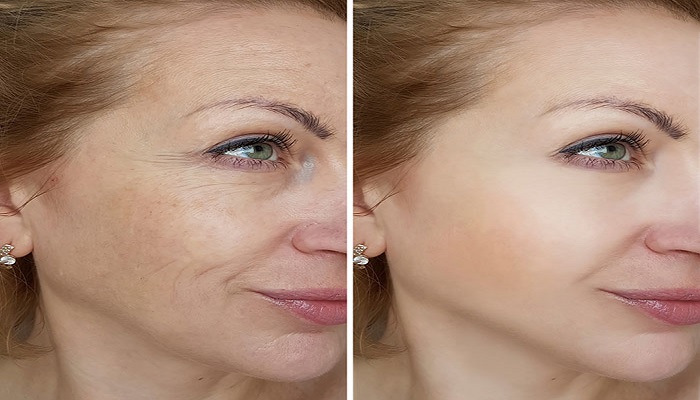 به مدت 48 ساعت از لوازم آرایشی و بهداشتی استفاده نکنید
