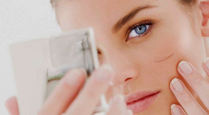 درمان لک صورت به وسیله لیزر کلینیک ارکید