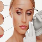 مزوتراپی-صورت-کلینیک-ارکید مزوتراپی صورت کلینیک ارکید