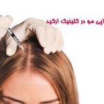 مزوتراپی-مو کلینیک ارکید مزوتراپی مو