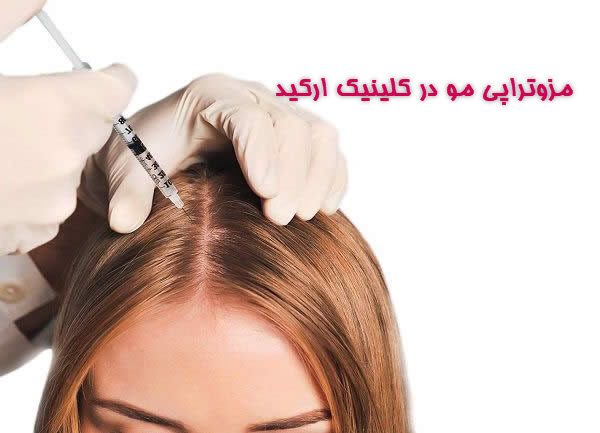 کلینیک ارکید   مزوتراپی مو