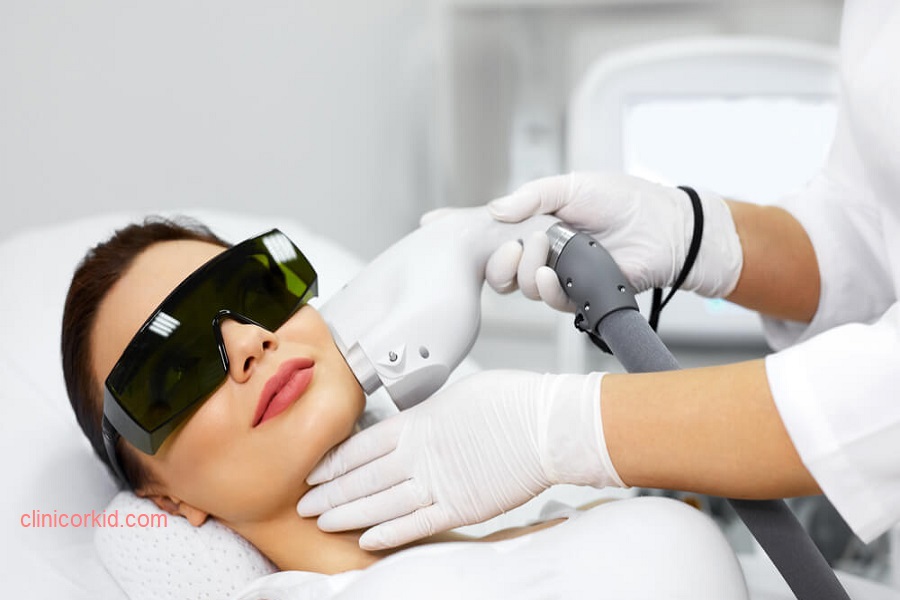 لیزر موهای زائد صورت در تهران کلینیک ارکید