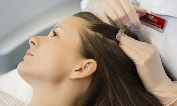مزوتراپی مو در کلینیک ارکید