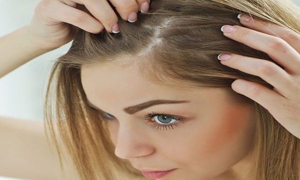کلینیک ارکید   مزوتراپی مو