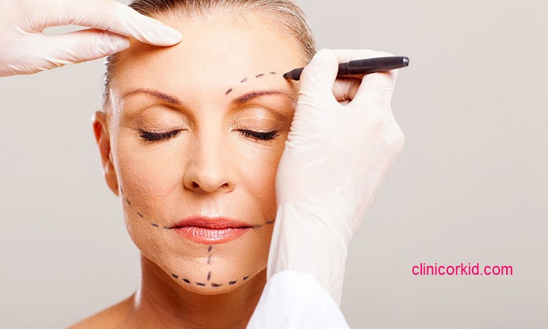 بهترین مرکز هایفوتراپی در پونک - کلینیک ارکید