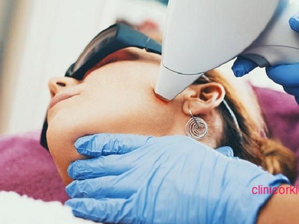 قیمت لیزر موهای زائد در پونک کلینیک ارکید