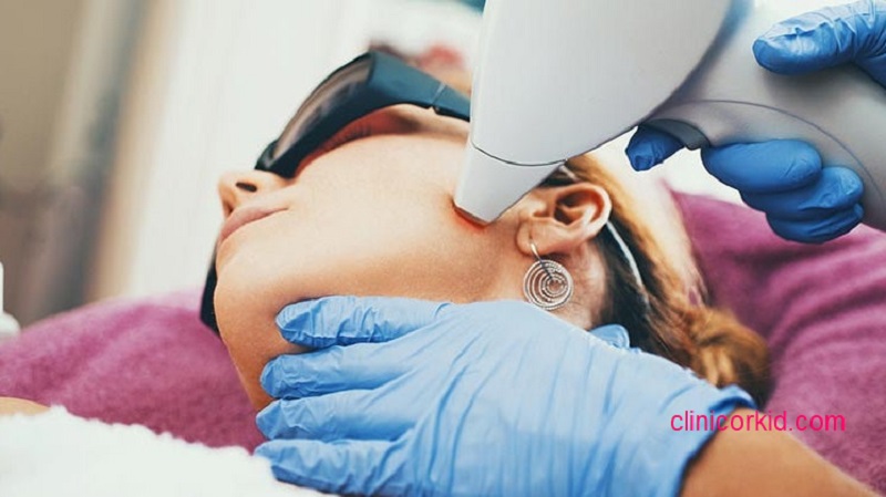 قیمت لیزر موهای زائد در پونک کلینیک ارکید