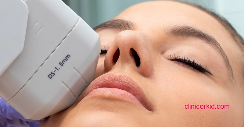 عوارض هایفوتراپی صورت کلینیک ارکید