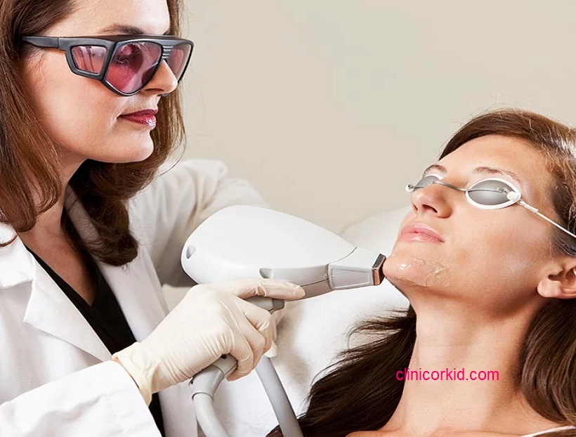 لیزر موهای زائد چانه کلینیک ارکید