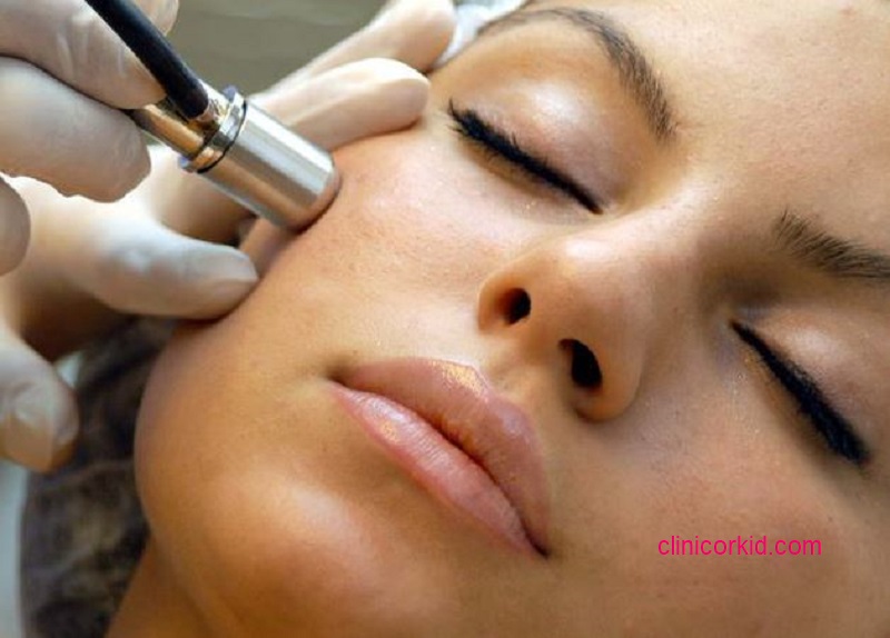 میکرودرم چند جلسه لازم دارد کلینیک ارکید