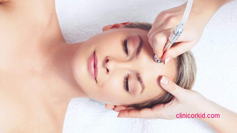 میکرودرم چگونه انجام می شود؟ کلینیک ارکید