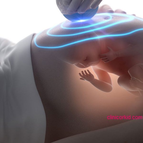 لیزر کردن در بارداری کلینیک ارکید