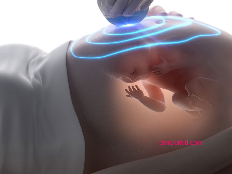 لیزر کردن در بارداری کلینیک ارکید