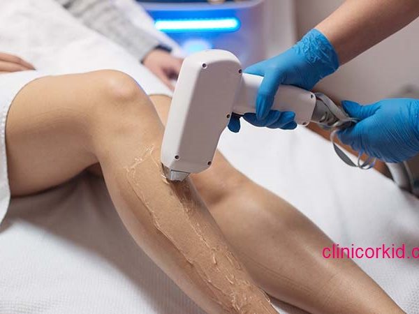 قیمت لیزر ساق پا   کلینیک ارکید