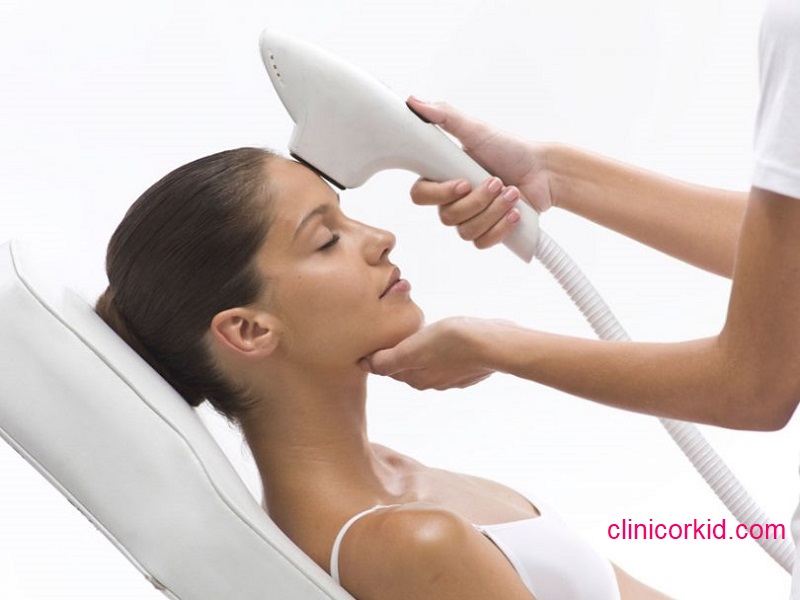 قیمت لیزر موی پیشانی - کلینیک ارکید