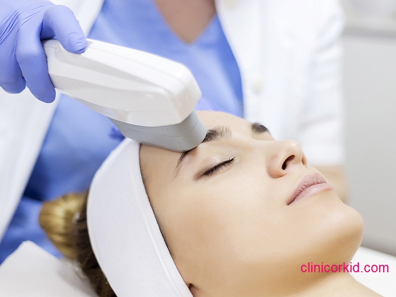 قیمت لیزر موی پیشانی کلینیک ارکید