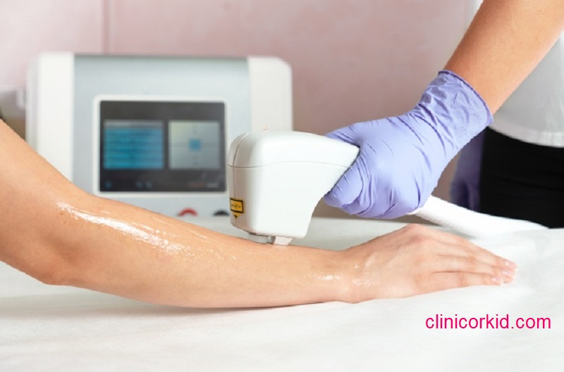 قیمت لیزر دست - کلینیک ارکید