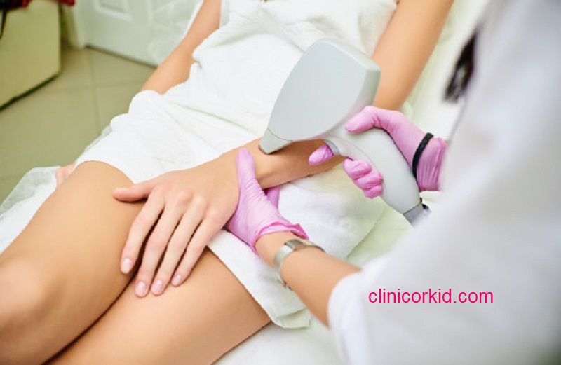 قیمت لیزر دست - کلینیک ارکید