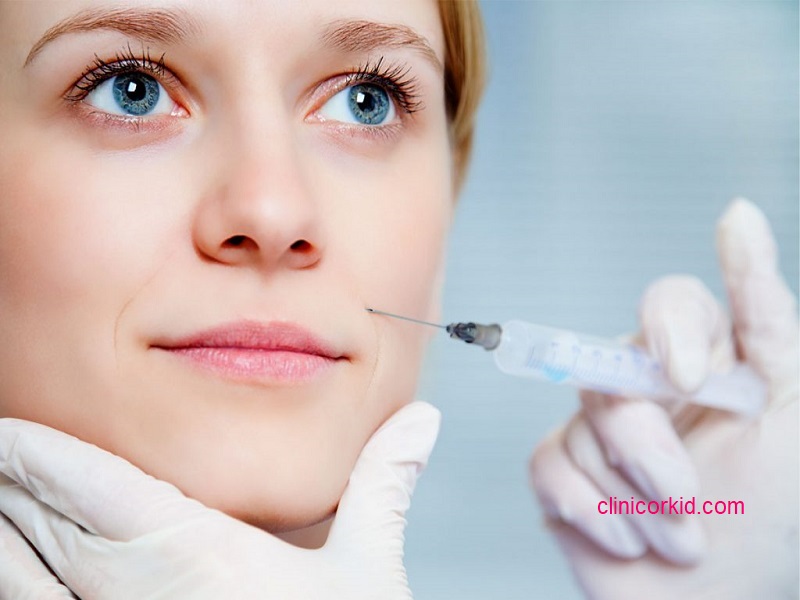 تزریق ژل خط خنده در غرب تهران کلینیک ارکید