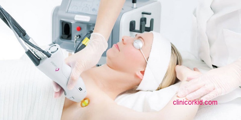 بهترین مرکز لیزر موهای زائد در تهران کجاست - کلینیک ارکید