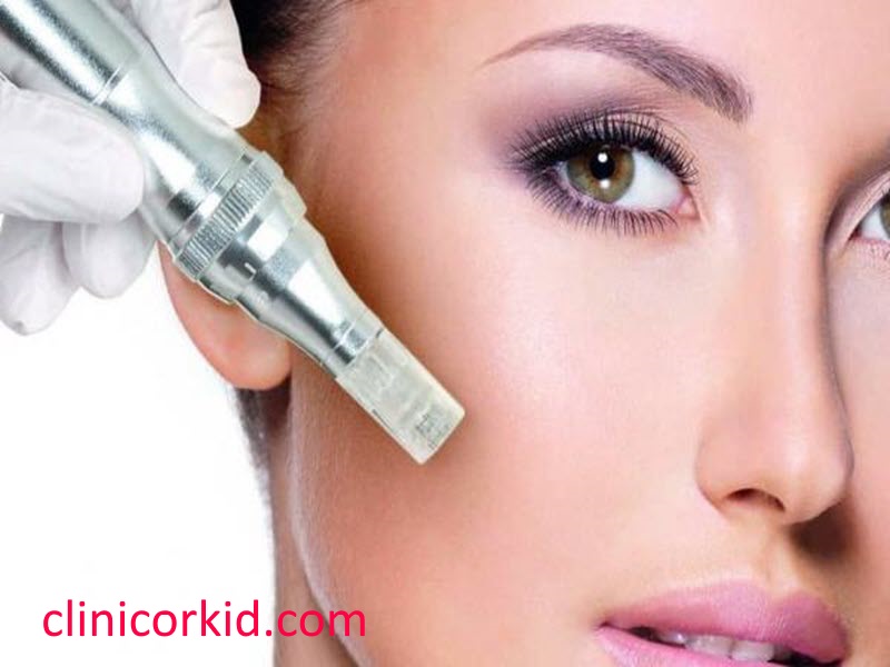 جوانسازی پوست با میکرونیدلینگ صورت-کلینیک ارکید