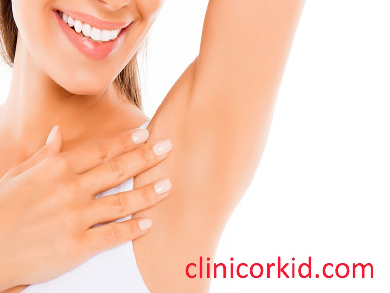 بهترین راه رفه موهای زائد کلینیک ارکید