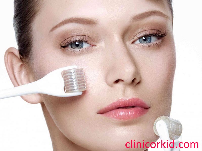 هزینه میکرونیدلینگ صورت کلینیک ارکید