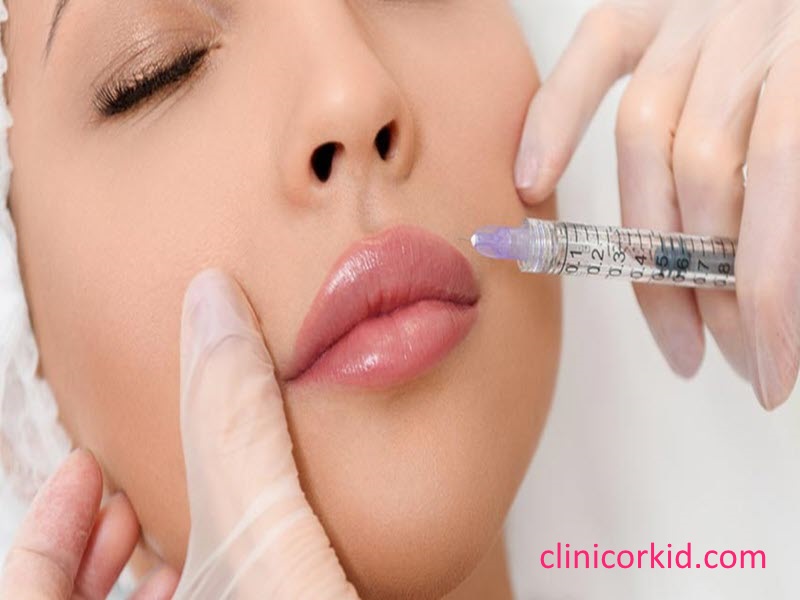 تزریق ژل با قیمت مناسب-کلینیک ارکید