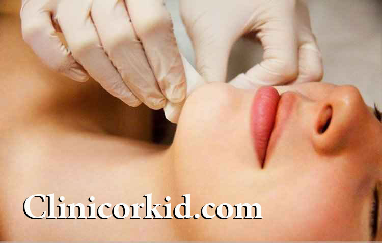 درمان همیشگی موهای زائد چانه | کلینیک ارکید