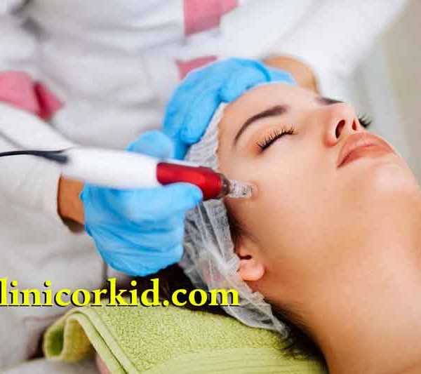 فوائد لیزر کردن موهای زائد بدن | کلینیک ارکید