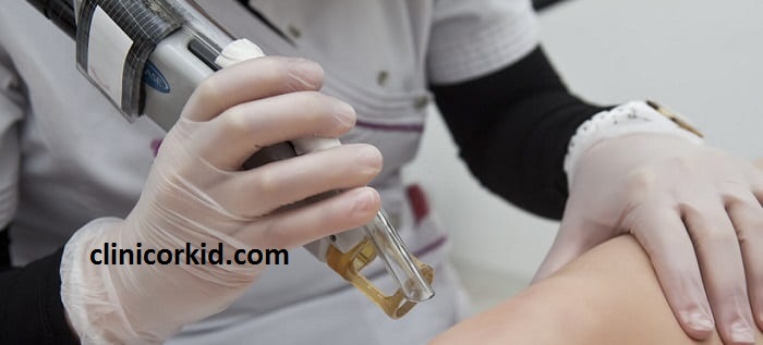 10 ویژگی برتر بهترین کلینیک لیزر مو | کلینیک ارکید