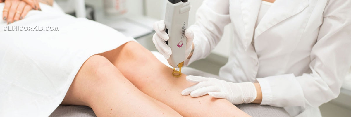 فواید لیزر موهای زائد پا چیست؟