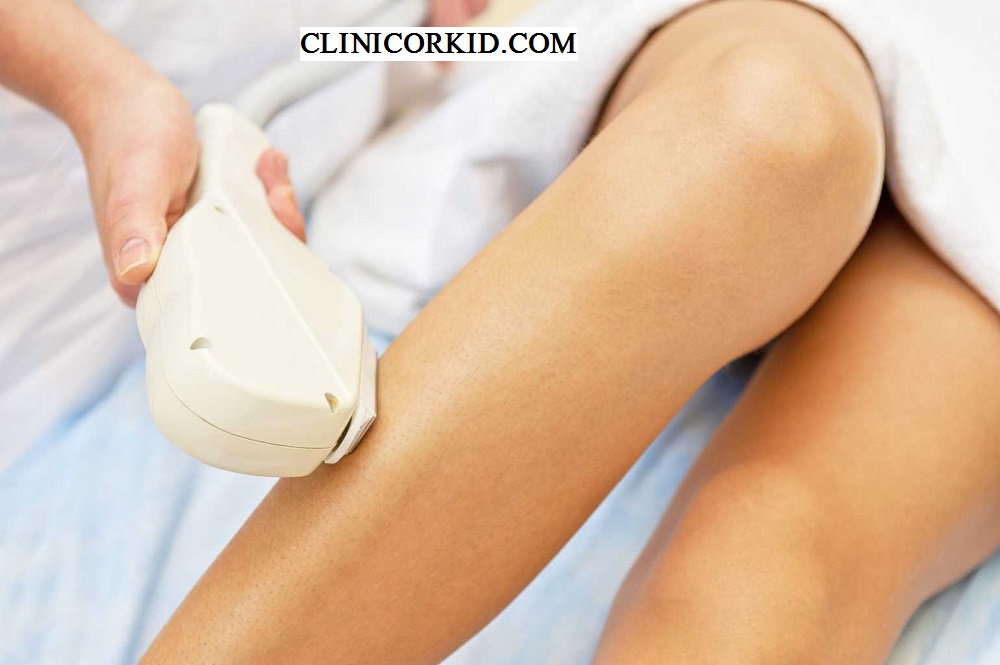قیمت لیزر موهای زائد در ارکید - کلینیک ارکید