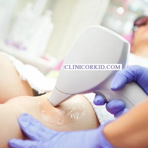 قیمت لیزر موهای زائد در ارکید کلینیک ارکید