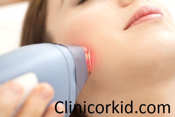 کلینیک لیزر موی زائد در تهران - کلینیک ارکید