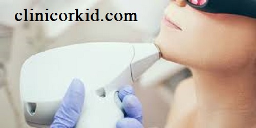قیمت لیزر موهای زائد چانه کلینیک ارکید