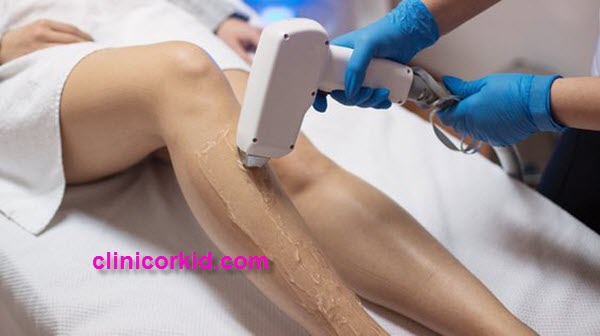 تخفیف لیزر کل بدن - کلینیک ارکید