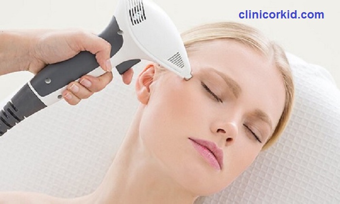 قیمت لیزر موهای بدن بانوان - کلینیک ارکید